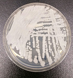 Candida auris in a petri dish